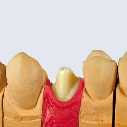 Sund Dental Dentallabor
